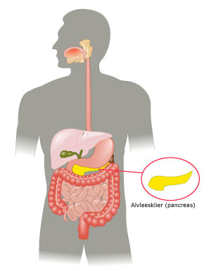 Figuur 1 diabetes